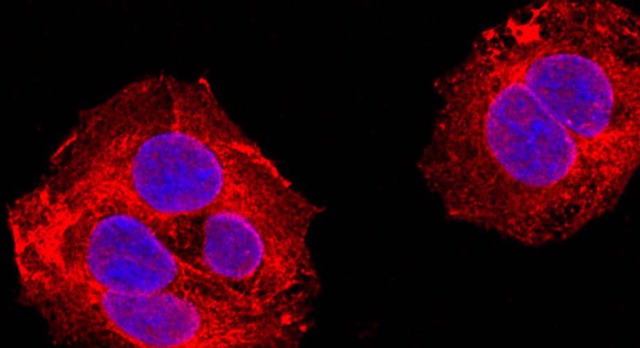 Protein-making enzymes